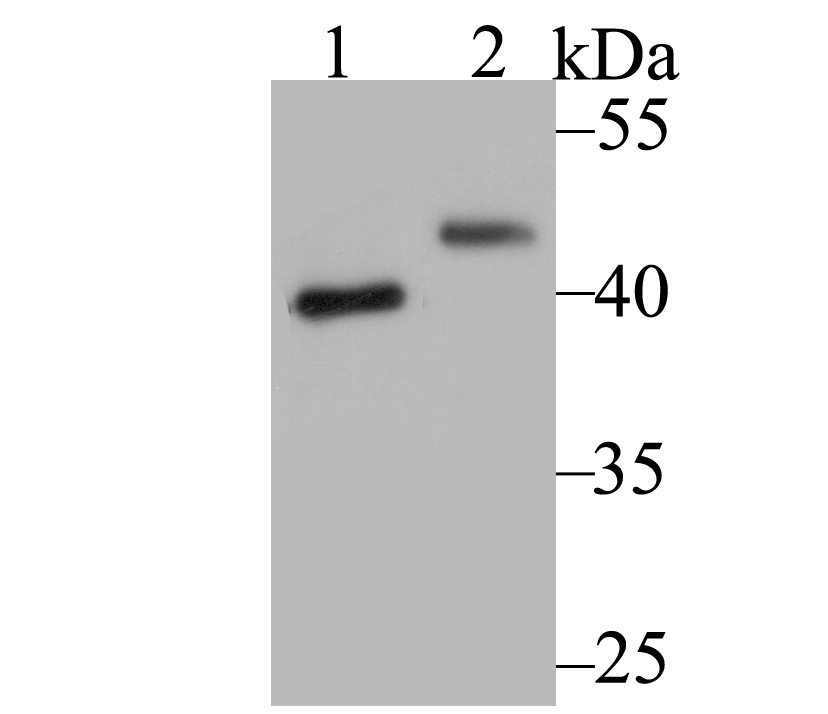 Lane 1: SiHa Cells; Lane 2: A549 Cells; Probed with SUV39H2 (2B10) Monoclonal Antibody (bsm-54372R) at 1:1000, overnight at 4°C followed by a conjugated secondary antibody for 60 minutes at 37°C.