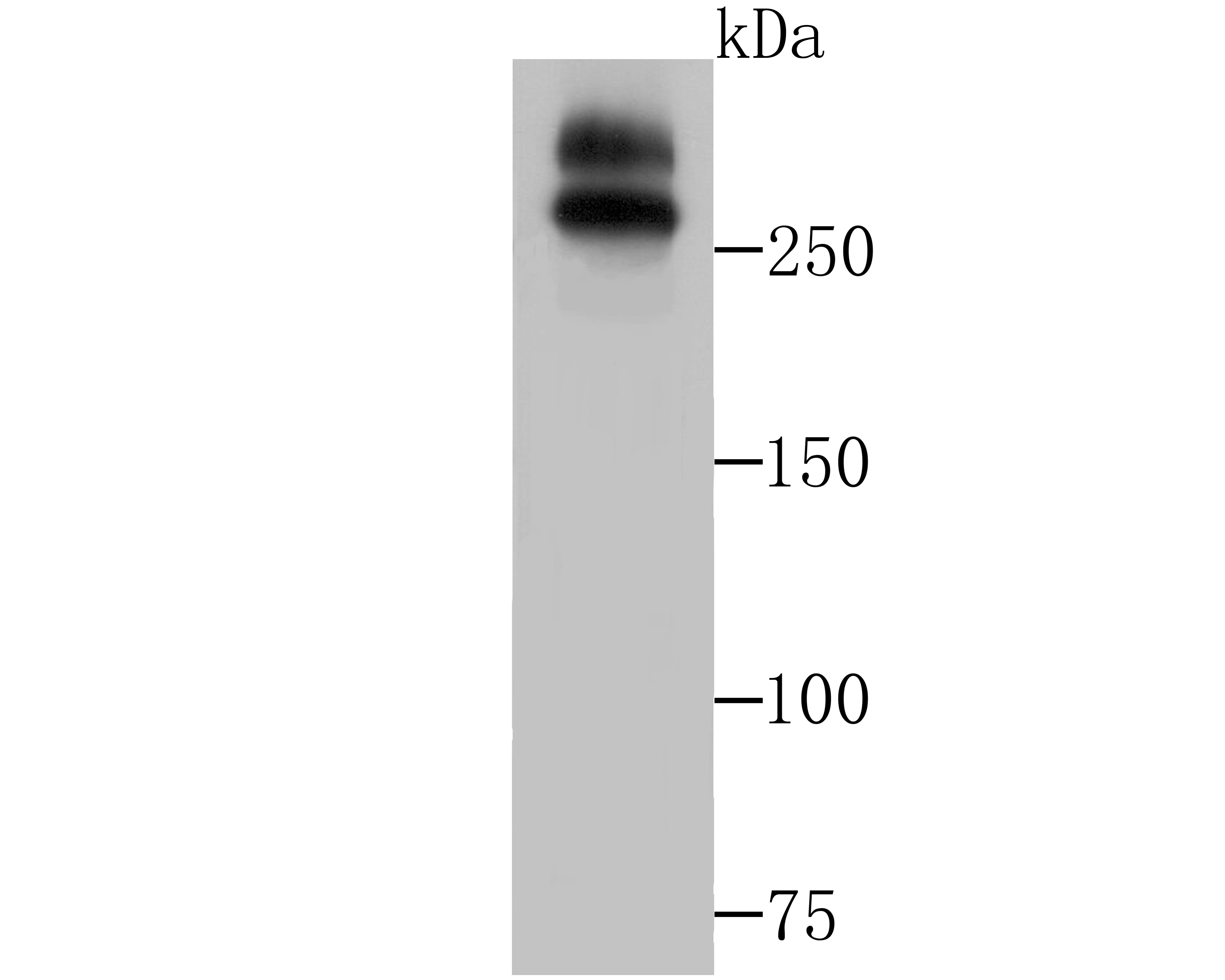 Lane 1: A549 Cells; Probed with WNK1 (7C9) Monoclonal Antibody (bsm-54375R) at 1:1000, overnight at 4°C followed by a conjugated secondary antibody for 60 minutes at 37°C.