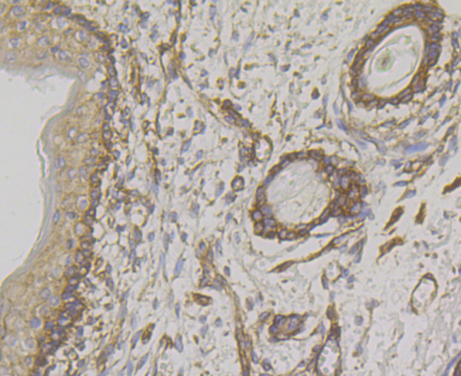 Paraformaldehyde-fixed and paraffin-embedded Human Skin tissue incubated with WNK1 (7C9) Monoclonal Antibody (bsm-54375R) at 1:100, overnight at 4°C, followed by a conjugated secondary antibody and DAB staining. Counterstained with hematoxylin.