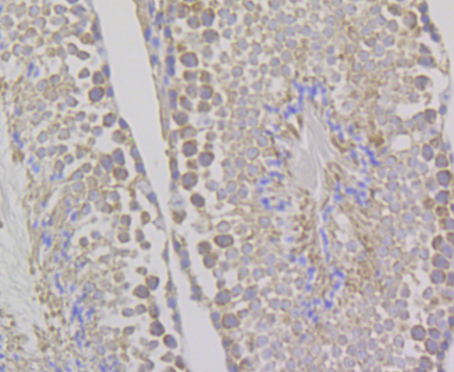 Paraformaldehyde-fixed and paraffin-embedded Mouse Testis tissue incubated with WNK1 (7C9) Monoclonal Antibody (bsm-54375R) at 1:100, overnight at 4°C, followed by a conjugated secondary antibody and DAB staining. Counterstained with hematoxylin.