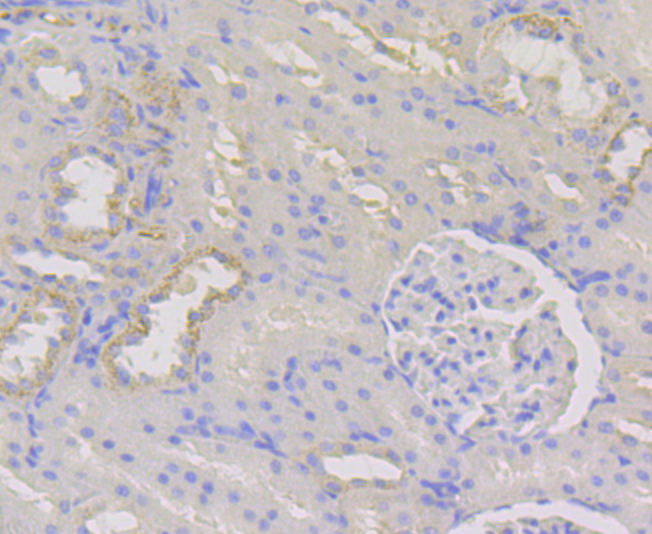 Paraformaldehyde-fixed and paraffin-embedded Rat Kidney tissue incubated with WNK1 (7C9) Monoclonal Antibody (bsm-54375R) at 1:100, overnight at 4°C, followed by a conjugated secondary antibody and DAB staining. Counterstained with hematoxylin.