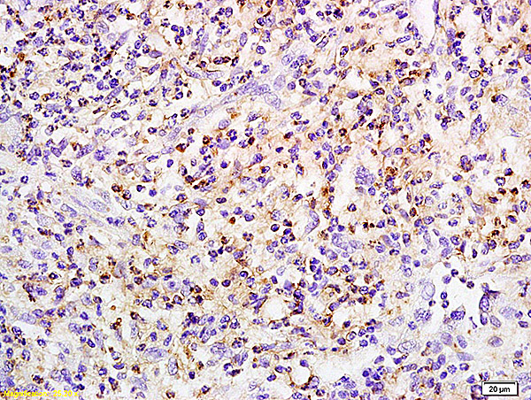 Formalin-fixed and paraffin embedded rat small intestine labeled with Anti phospho-PRKCB(Ser642) Polyclonal Antibody, Unconjugated (bs-5566R) at 1:200 followed by conjugation to the secondary antibody and DAB staining