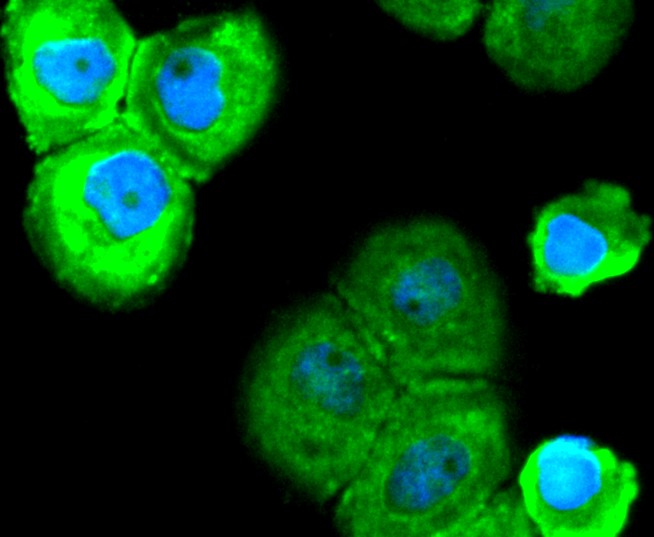 IF(ICC) staining with SOX10 (9A44) Monoclonal Antibody (bsm-52642R) at 1:300 in A431 cells (green). The nuclear counterstain is DAPI (blue). Cells were fixed in paraformaldehyde, permeabilized with 0.25% Triton X100/PBS.