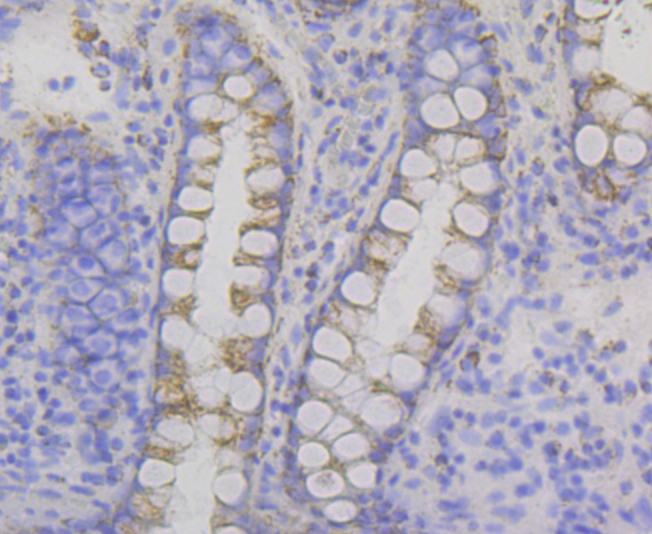 Paraformaldehyde-fixed and paraffin-embedded Human Colon tissue incubated with P2Y6 (8H2) Monoclonal Antibody (bsm-54386R) at 1:100, overnight at 4°C, followed by a conjugated secondary antibody and DAB staining. Counterstained with hematoxylin.