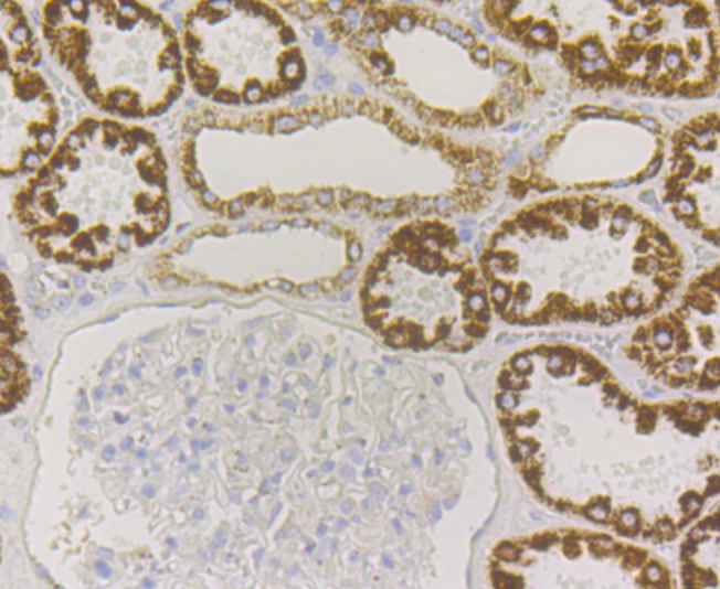 Paraformaldehyde-fixed and paraffin-embedded Human Kidney tissue incubated with P2Y6 (8H2) Monoclonal Antibody (bsm-54386R) at 1:100, overnight at 4°C, followed by a conjugated secondary antibody and DAB staining. Counterstained with hematoxylin. Paraformaldehyde-fixed and paraffin-embedded Human Kidney tissue incubated with P2Y6 (8H2) Monoclonal Antibody (bsm-54386R) at 1:100, overnight at 4°C, followed by a conjugated secondary antibody and DAB staining. Counterstained with hematoxylin.