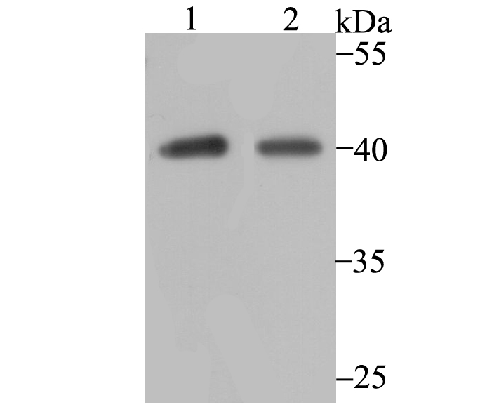 Lane 1: SK-BR-3 Cells; Lane 2: A549 Cells; Probed with P2Y6 (8H2) Monoclonal Antibody (bsm-54386R) at 1:1000, overnight at 4°C followed by a conjugated secondary antibody for 60 minutes at 37°C. Lane 1: SK-BR-3 Cells; Lane 2: A549 Cells; Probed with P2Y6 (8H2) Monoclonal Antibody (bsm-54386R) at 1:1000, overnight at 4°C followed by a conjugated secondary antibody for 60 minutes at 37°C.
