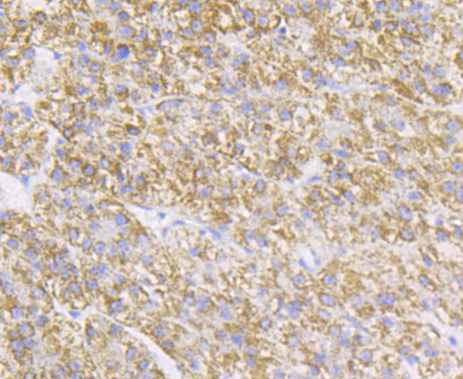 Paraformaldehyde-fixed and paraffin-embedded Human Liver tissue incubated with P2Y6 (8H2) Monoclonal Antibody (bsm-54386R) at 1:100, overnight at 4°C, followed by a conjugated secondary antibody and DAB staining. Counterstained with hematoxylin. Paraformaldehyde-fixed and paraffin-embedded Human Liver tissue incubated with P2Y6 (8H2) Monoclonal Antibody (bsm-54386R) at 1:100, overnight at 4°C, followed by a conjugated secondary antibody and DAB staining. Counterstained with hematoxylin.
