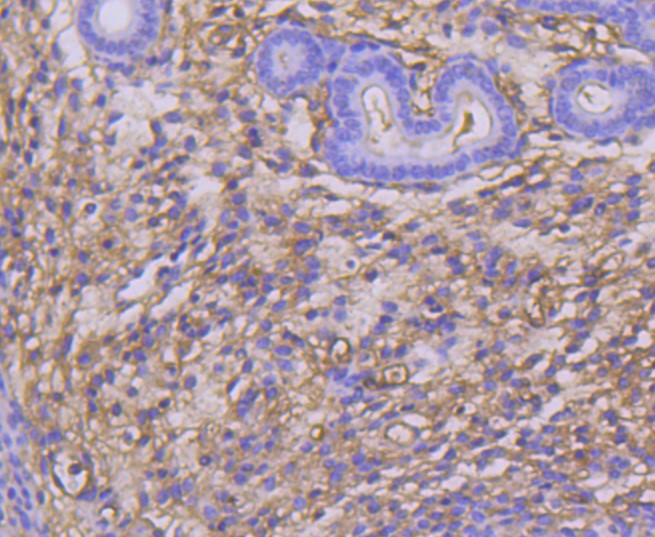 Paraformaldehyde-fixed and paraffin-embedded Mouse uterus tissue incubated with TWEAKR (2C14) Monoclonal Antibody (bsm-52646R) at 1:100, overnight at 4°C, followed by a conjugated secondary antibody and DAB staining. Counterstained with hematoxylin.