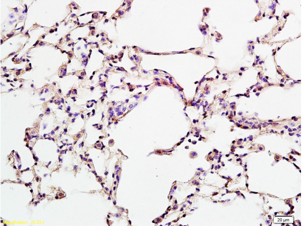 Formalin-fixed and rat lung tissue labeled with Anti-B7-H1/PD-L1/CD274 Polyclonal Antibody, Unconjugated(bs-1103R) at 1:200 followed by conjugation to the secondary antibody and DAB staining