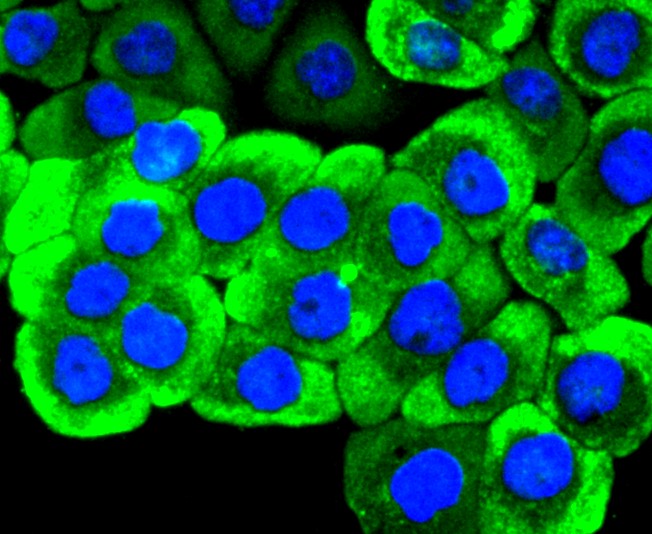 IF(ICC) staining with Ret (4C3) Monoclonal Antibody (bsm-52650R) at 1:300 in AGS cells (green). The nuclear counterstain is DAPI (blue). Cells were fixed in paraformaldehyde, permeabilized with 0.25% Triton X100/PBS.