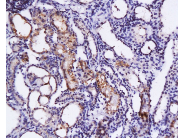 Formalin-fixed and paraffin embedded rat kidney tissue labeled with Anti-SCF Polyclonal Antibody (bs-0545R), Unconjugated at 1:200, followed by conjugation to the secondary antibody and DAB staining