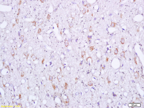 Formalin-fixed and paraffin embedded rat brain labeled with Rabbit Anti Sigma1R/OPRS1/Sigma Receptor Polyclonal Antibody, Unconjugated (bs-5111R) at 1:200 followed by conjugation to the secondary antibody and DAB staining