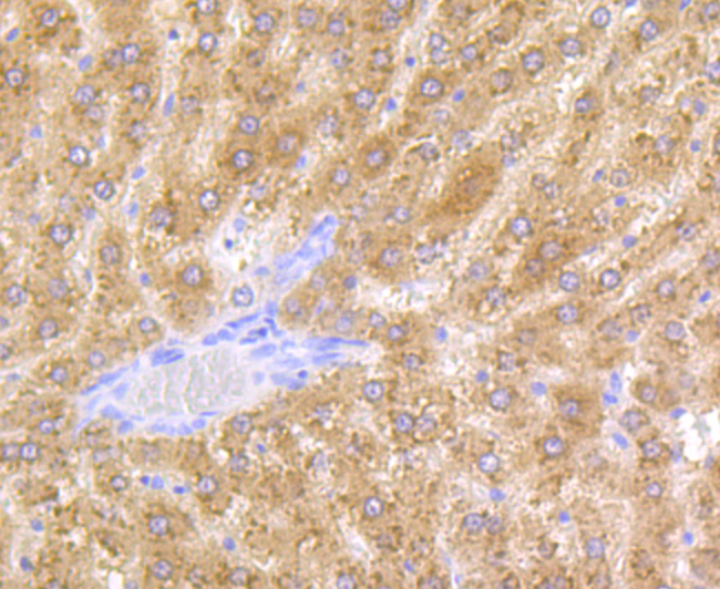 Paraformaldehyde-fixed and paraffin-embedded Rat Liver tissue incubated with ADH1A (2G4) Monoclonal Antibody (bsm-54396R) at 1:100, overnight at 4°C, followed by a conjugated secondary antibody and DAB staining. Counterstained with hematoxylin.