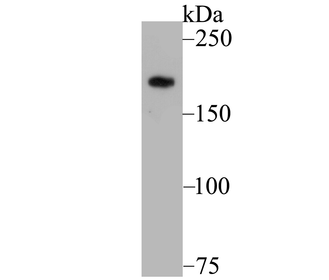 Lane 1: PC-3M Cells; Probed with GLI3 (45G1) Monoclonal Antibody (bsm-54400R) at 1:1000, overnight at 4°C followed by a conjugated secondary antibody for 60 minutes at 37°C.