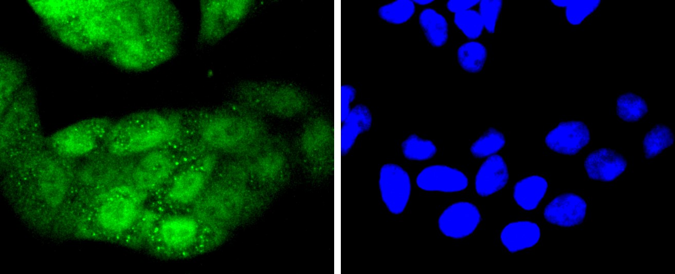 IF(ICC) staining with Cdk4 (6A4) Monoclonal Antibody (bsm-52651R) at 1:300 in HeLa cells (green). The nuclear counterstain is DAPI (blue). Cells were fixed in paraformaldehyde, permeabilized with 0.25% Triton X100/PBS.