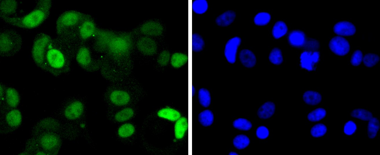 IF(ICC) staining with Cdk4 (6A4) Monoclonal Antibody (bsm-52651R) at 1:300 in MCF-7 cells (green). The nuclear counterstain is DAPI (blue). Cells were fixed in paraformaldehyde, permeabilized with 0.25% Triton X100/PBS.