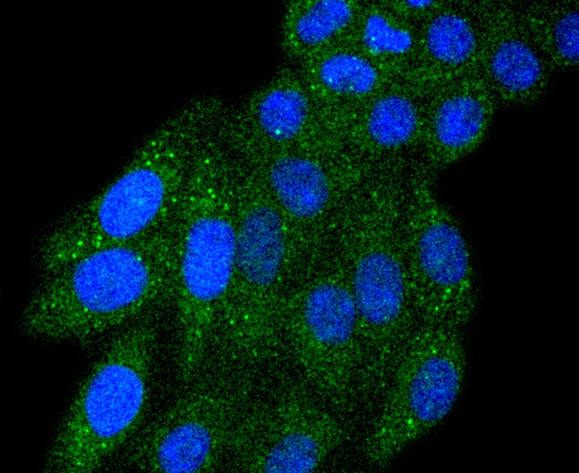 IF(ICC) staining with IRF5 (2C5) Monoclonal Antibody (bsm-52655R) at 1:100 in HepG2 cells (green). The nuclear counterstain is DAPI (blue). Cells were fixed in paraformaldehyde, permeabilized with 0.25% Triton X100/PBS.