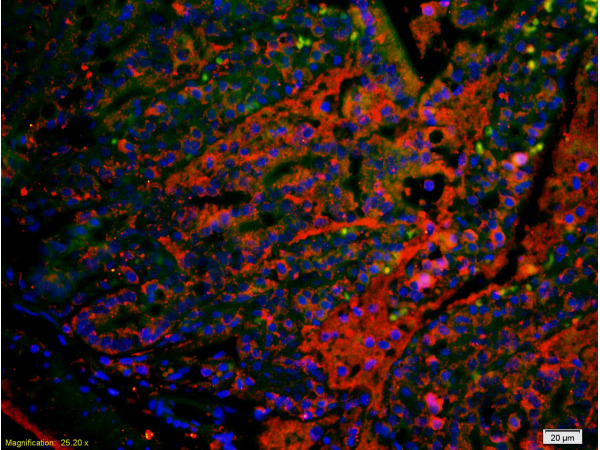 Formalin-fixed and paraffin embedded mouse small intestine labeled with Anti TSPAN20/UPIb Polyclonal Antibody, PE conjugated (bs-9426R-PE) 1:200, 60 minutes at 37°C. DAPI(5ug/ml,blue) was used to stain the cell nuclei