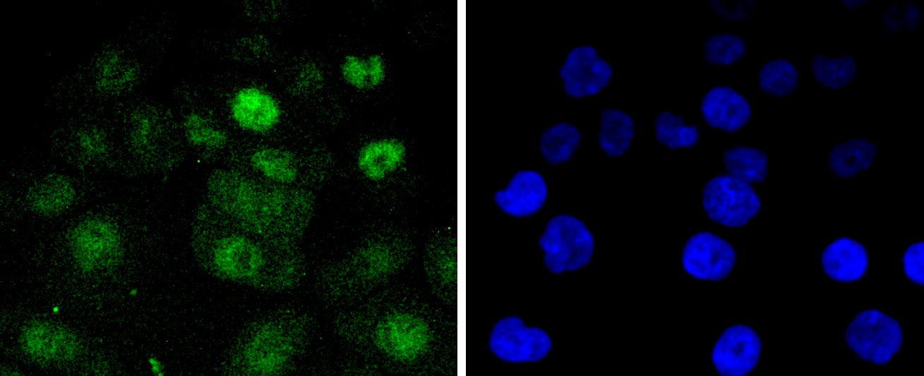 IF(ICC) staining with Cdk4 (7G7) Monoclonal Antibody (bsm-52659R) at 1:100 in AGS cells (green). The nuclear counterstain is DAPI (blue). Cells were fixed in paraformaldehyde, permeabilized with 0.25% Triton X100/PBS.