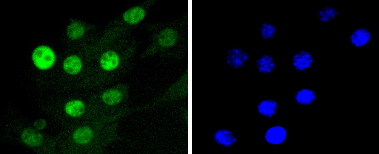 IF(ICC) staining with Cdk4 (7G7) Monoclonal Antibody (bsm-52659R) at 1:100 in NIH/3T3 cells (green). The nuclear counterstain is DAPI (blue). Cells were fixed in paraformaldehyde, permeabilized with 0.25% Triton X100/PBS.