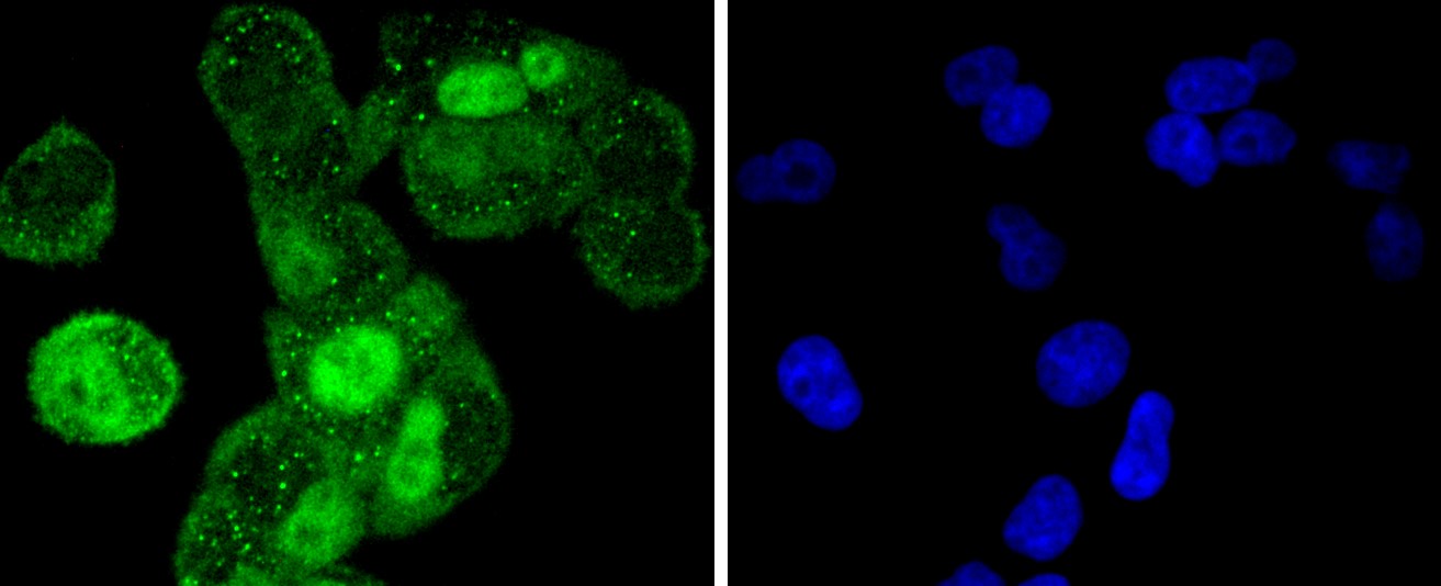 IF(ICC) staining with Cyclin A2 (2C2) Monoclonal Antibody (bsm-52660R) at 1:300 in HeLa cells (green). The nuclear counterstain is DAPI (blue). Cells were fixed in paraformaldehyde, permeabilized with 0.25% Triton X100/PBS.