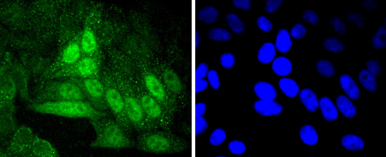 IF(ICC) staining with Cyclin A2 (2C2) Monoclonal Antibody (bsm-52660R) at 1:300 in HepG2 cells (green). The nuclear counterstain is DAPI (blue). Cells were fixed in paraformaldehyde, permeabilized with 0.25% Triton X100/PBS.