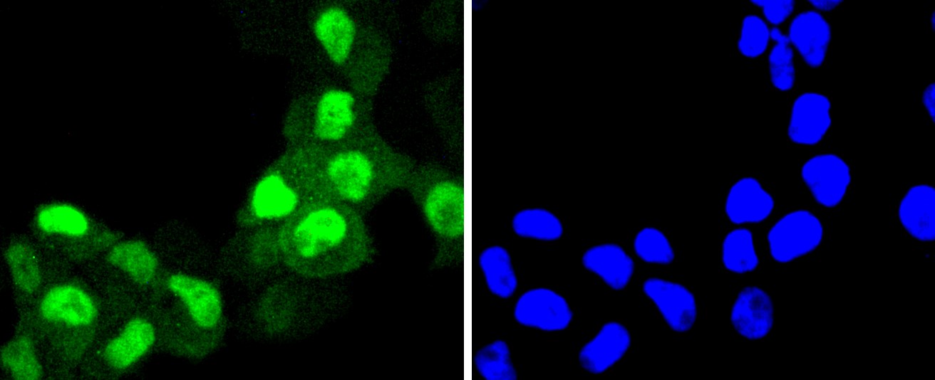 IF(ICC) staining with Cyclin A2 (2C2) Monoclonal Antibody (bsm-52660R) at 1:300 in RH-35 cells (green). The nuclear counterstain is DAPI (blue). Cells were fixed in paraformaldehyde, permeabilized with 0.25% Triton X100/PBS.