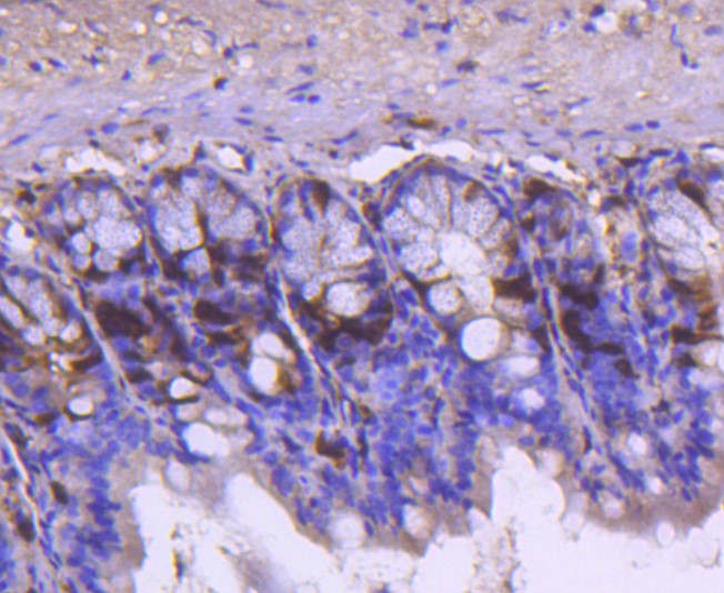 Paraformaldehyde-fixed and paraffin-embedded Mouse colon tissue incubated with Cyclin A2 (2C2) Monoclonal Antibody (bsm-52660R) at 1:100, overnight at 4°C, followed by a conjugated secondary antibody and DAB staining. Counterstained with hematoxylin.