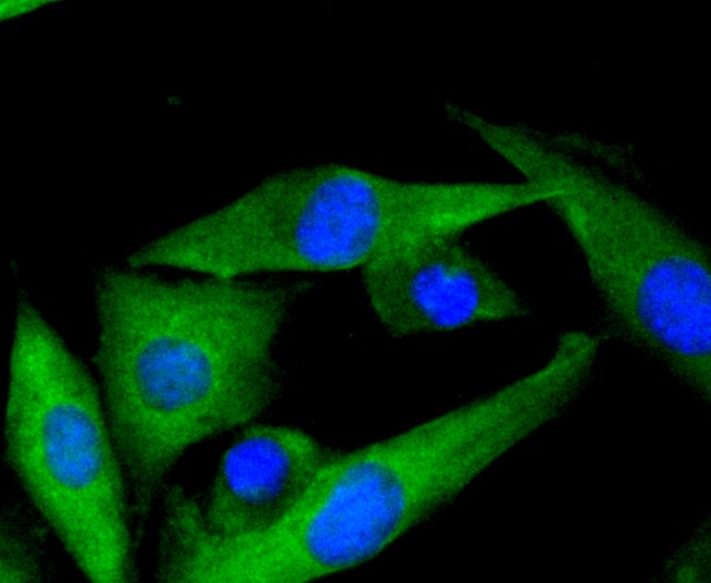 IF(ICC) staining with MEK7 (7C6) Monoclonal Antibody (bsm-52666R) at 1:100 in SHG-44 cells (green). The nuclear counterstain is DAPI (blue). Cells were fixed in paraformaldehyde, permeabilized with 0.25% Triton X100/PBS.