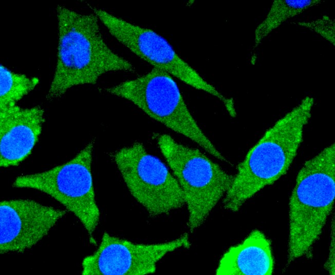 IF(ICC) staining with MEK7 (7C6) Monoclonal Antibody (bsm-52666R) at 1:100 in SH-SY5Y cells (green). The nuclear counterstain is DAPI (blue). Cells were fixed in paraformaldehyde, permeabilized with 0.25% Triton X100/PBS.