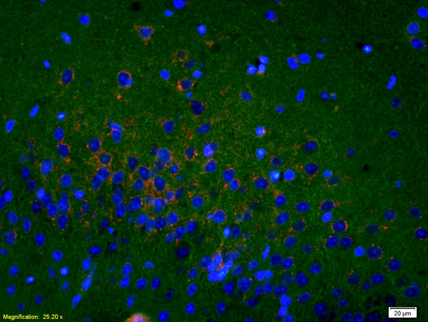 Formalin-fixed and paraffin embedded rat brain labeled with Rabbit Anti Sigma1R/OPRS1/Sigma Receptor Polyclonal Antibody, Unconjugated (bs-5111R) at 1:200, overnight at 4°C. The secondary antibody was Goat Anti-Rabbit IgG, Cy3 conjugated(bs-0295G-Cy3)used at 1:200 dilution for 40 minutes at 37°C.