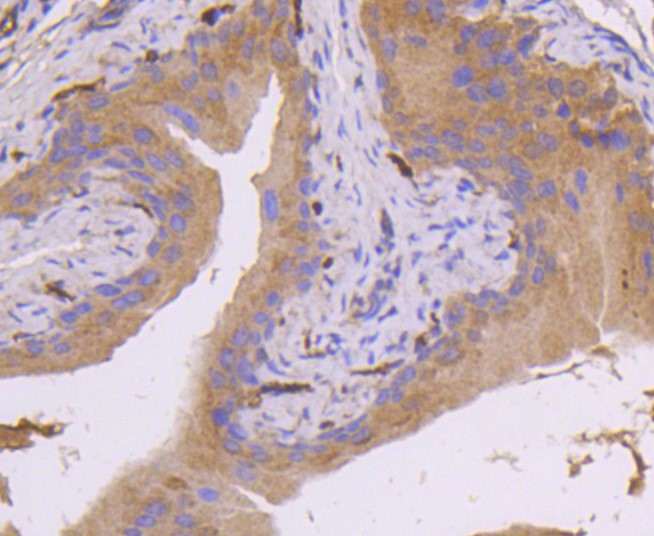 Paraformaldehyde-fixed and paraffin-embedded Mouse bladder tissue incubated with MEK7 (7C6) Monoclonal Antibody (bsm-52666R) at 1:100, overnight at 4°C, followed by a conjugated secondary antibody and DAB staining. Counterstained with hematoxylin.