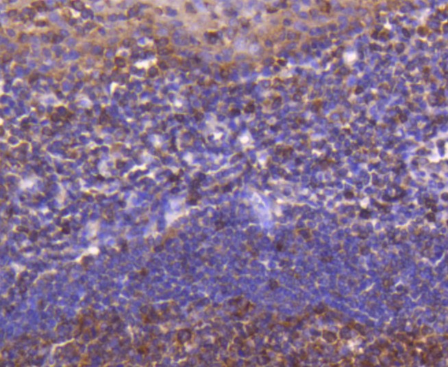 Paraformaldehyde-fixed and paraffin-embedded Human tonsil tissue incubated with ATF5 (7C4) Monoclonal Antibody (bsm-52668R) at 1:100, overnight at 4°C, followed by a conjugated secondary antibody and DAB staining. Counterstained with hematoxylin.