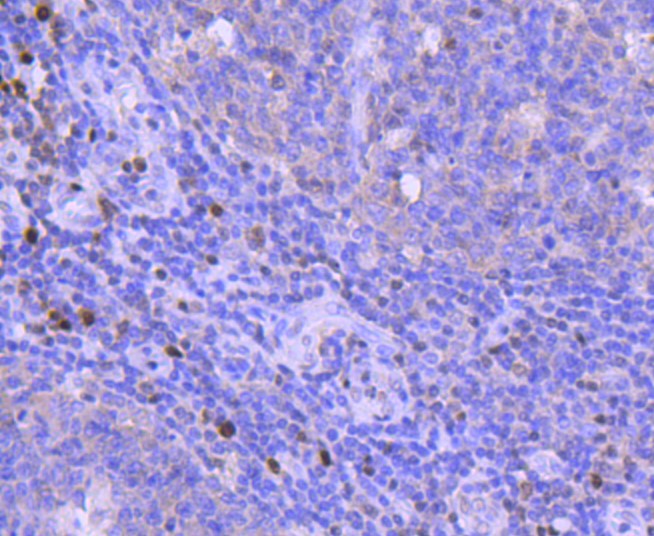 Paraformaldehyde-fixed and paraffin-embedded Human tonsil tissue incubated with RUNX2 (3C5) Monoclonal Antibody (bsm-52672R) at 1:100, overnight at 4°C, followed by a conjugated secondary antibody and DAB staining. Counterstained with hematoxylin.
