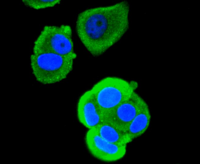 IF(ICC) staining with RUNX1+RUNX2+RUNX3 (1C3) Monoclonal Antibody (bsm-52674R) at 1:100 in MCF-7 cells (green). The nuclear counterstain is DAPI (blue). Cells were fixed in paraformaldehyde, permeabilized with 0.25% Triton X100/PBS.