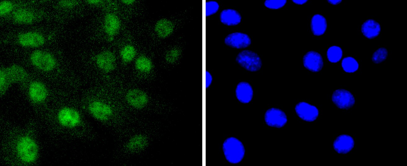 IF(ICC) staining with RUNX1+RUNX2+RUNX3 (1C3) Monoclonal Antibody (bsm-52674R) at 1:100 in SHG-44 cells (green). The nuclear counterstain is DAPI (blue). Cells were fixed in paraformaldehyde, permeabilized with 0.25% Triton X100/PBS.