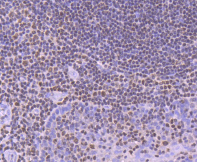 Paraformaldehyde-fixed and paraffin-embedded Human tonsil tissue incubated with RUNX1+RUNX2+RUNX3 (1C3) Monoclonal Antibody (bsm-52674R) at 1:100, overnight at 4°C, followed by a conjugated secondary antibody and DAB staining. Counterstained with hematoxylin.