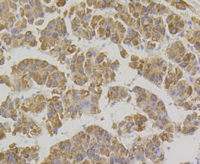 Paraformaldehyde-fixed and paraffin-embedded Human Liver tissue incubated with Xanthine Oxidase (2D9) Monoclonal Antibody (bsm-54401R) at 1:100, overnight at 4°C, followed by a conjugated secondary antibody and DAB staining. Counterstained with hematoxylin. Paraformaldehyde-fixed and paraffin-embedded Human Liver tissue incubated with Xanthine Oxidase (2D9) Monoclonal Antibody (bsm-54401R) at 1:100, overnight at 4°C, followed by a conjugated secondary antibody and DAB staining. Counterstained with hematoxylin.