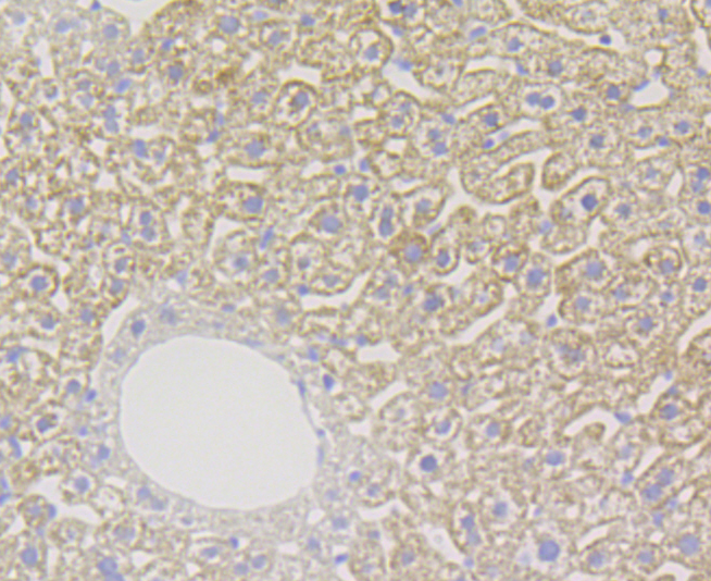 Paraformaldehyde-fixed and paraffin-embedded Human Liver tissue incubated with Xanthine Oxidase (2D9) Monoclonal Antibody (bsm-54401R) at 1:100, overnight at 4°C, followed by a conjugated secondary antibody and DAB staining. Counterstained with hematoxylin. Paraformaldehyde-fixed and paraffin-embedded Human Liver tissue incubated with Xanthine Oxidase (2D9) Monoclonal Antibody (bsm-54401R) at 1:100, overnight at 4°C, followed by a conjugated secondary antibody and DAB staining. Counterstained with hematoxylin.