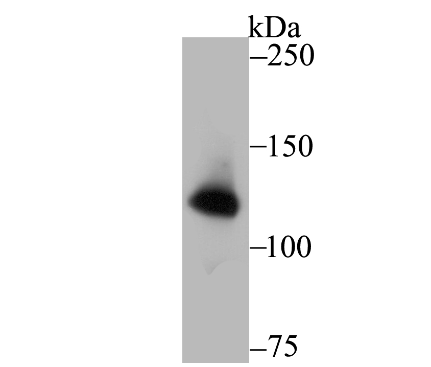 Lane 1: PC-3M Cells; Probed with UPF1 (9A3) Monoclonal Antibody (bsm-54402R) at 1:1000, overnight at 4°C followed by a conjugated secondary antibody for 60 minutes at 37°C.