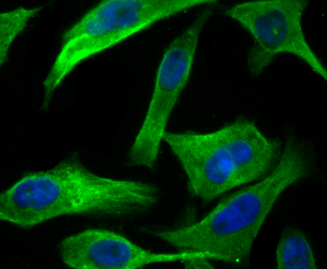 IF(ICC) staining with UPF1 (9A3) Monoclonal Antibody (bsm-54402R) at 1:100 in PC-3M cells (green). The nuclear counterstain is DAPI (blue). Cells were fixed in paraformaldehyde, permeabilized with 0.25% Triton X100/PBS.