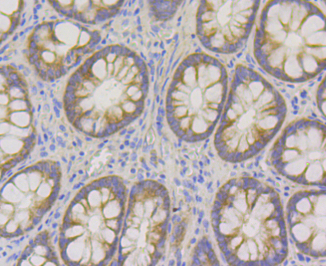Paraformaldehyde-fixed and paraffin-embedded Human Colon tissue incubated with UPF1 (9A3) Monoclonal Antibody (bsm-54402R) at 1:100, overnight at 4°C, followed by a conjugated secondary antibody and DAB staining. Counterstained with hematoxylin.