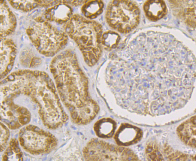 Paraformaldehyde-fixed and paraffin-embedded Human Kidney tissue incubated with UPF1 (9A3) Monoclonal Antibody (bsm-54402R) at 1:100, overnight at 4°C, followed by a conjugated secondary antibody and DAB staining. Counterstained with hematoxylin.