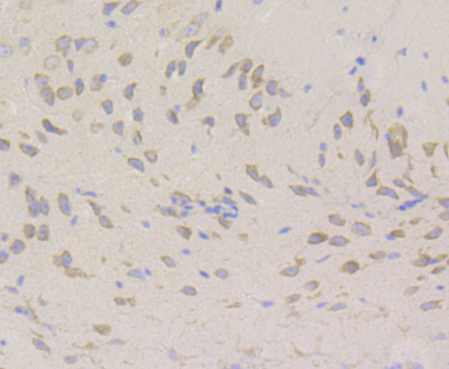 Paraformaldehyde-fixed and paraffin-embedded Mouse Brain tissue incubated with UPF1 (9A3) Monoclonal Antibody (bsm-54402R) at 1:100, overnight at 4°C, followed by a conjugated secondary antibody and DAB staining. Counterstained with hematoxylin.