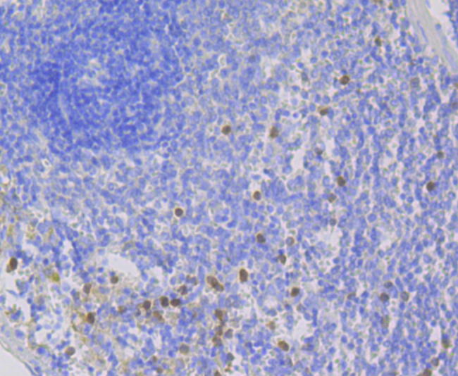 Paraformaldehyde-fixed and paraffin-embedded Rat Spleen tissue incubated with NCF2 (3A1) Monoclonal Antibody (bsm-54404R) at 1:100, overnight at 4°C, followed by a conjugated secondary antibody and DAB staining. Counterstained with hematoxylin.