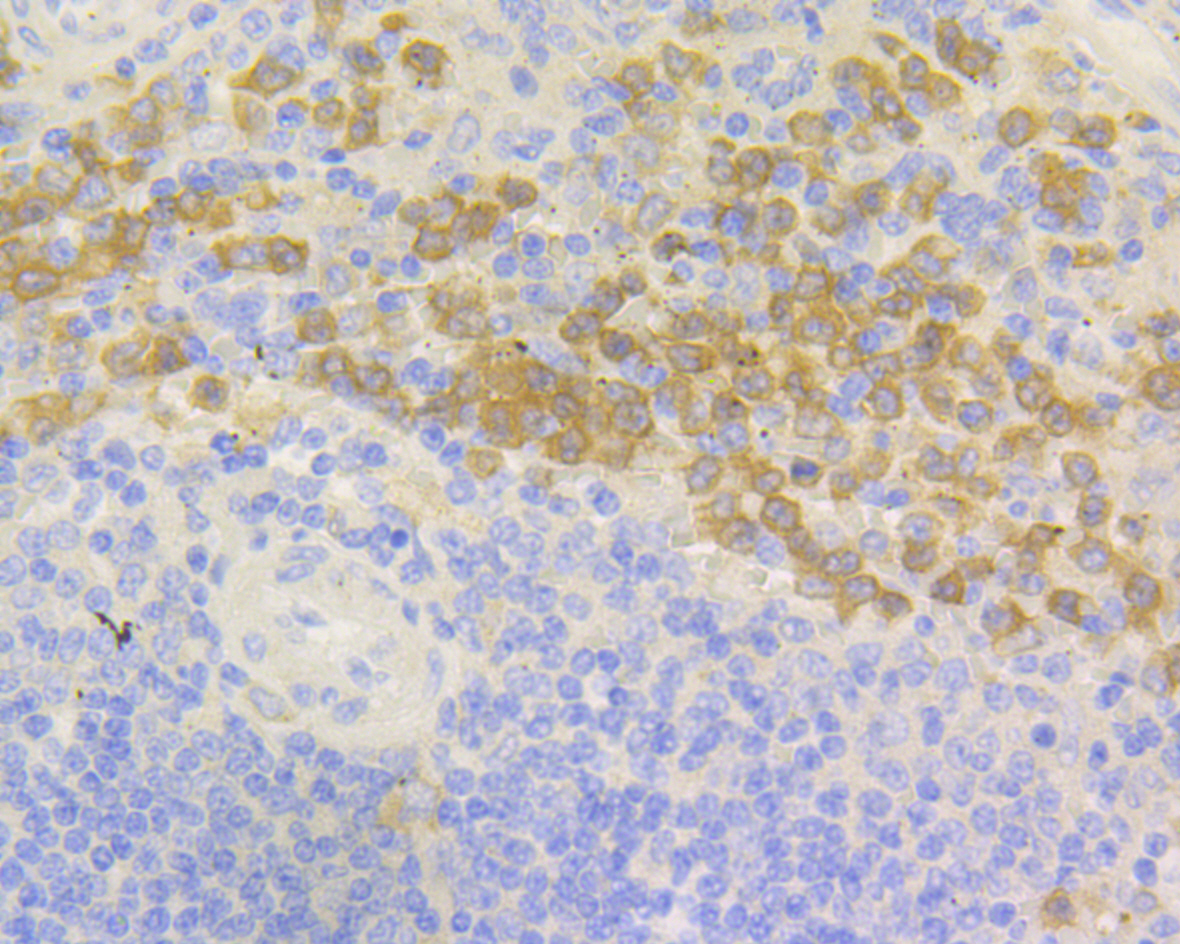 Paraformaldehyde-fixed and paraffin-embedded Human Spleen tissue incubated with NCF2 (3A1) Monoclonal Antibody (bsm-54404R) at 1:100, overnight at 4°C, followed by a conjugated secondary antibody and DAB staining. Counterstained with hematoxylin.