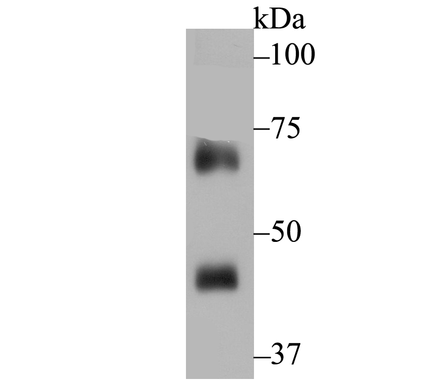 Lane 1: Rat Spleen; Probed with NCF2 (3A1) Monoclonal Antibody (bsm-54404R) at 1:500, overnight at 4°C followed by a conjugated secondary antibody for 60 minutes at 37°C.
