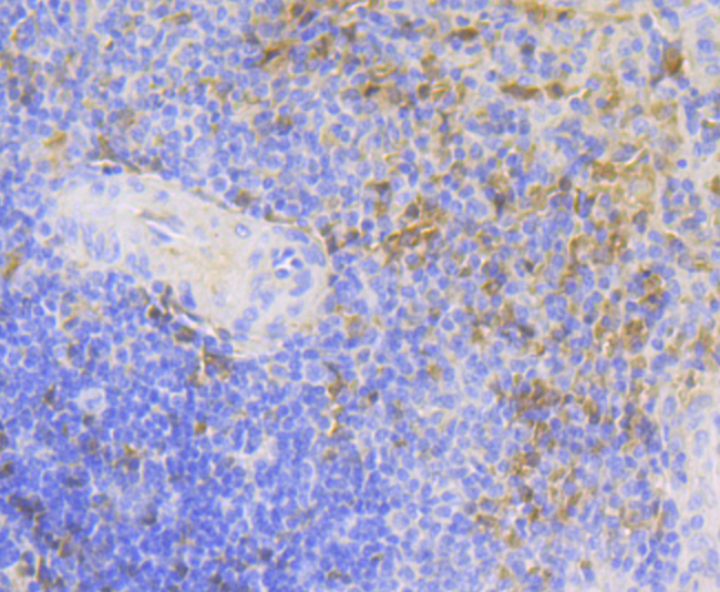 Paraformaldehyde-fixed and paraffin-embedded Human Spleen tissue incubated with Carbonic Anhydrase I (2H4) Monoclonal Antibody (bsm-54409R) at 1:100, overnight at 4°C, followed by a conjugated secondary antibody and DAB staining. Counterstained with hematoxylin.