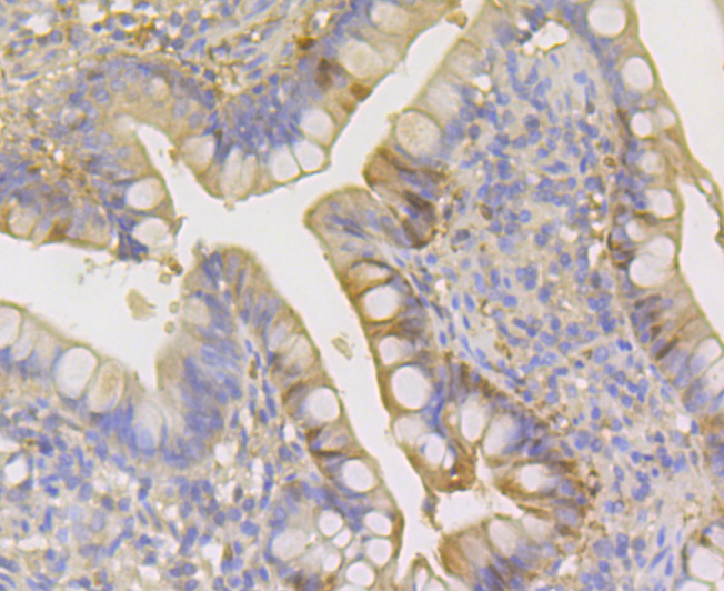 Paraformaldehyde-fixed and paraffin-embedded Human Small Intestine tissue incubated with Carbonic Anhydrase I (2H4) Monoclonal Antibody (bsm-54409R) at 1:100, overnight at 4°C, followed by a conjugated secondary antibody and DAB staining. Counterstained with hematoxylin.