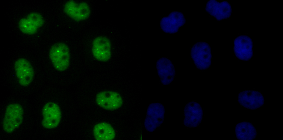 IF(ICC) staining with BUB3 (24D1) Monoclonal Antibody (bsm-54413R) 1:100 in A431 cells (green). The nuclear counterstain is DAPI (blue). Cells were fixed in paraformaldehyde, permeabilized with 0.25% Triton X100/PBS.